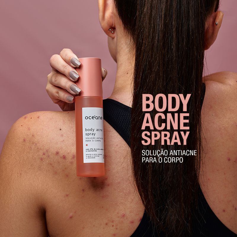 AP2001013CUNIT_solucao_antiacne_para_o_corpo_body_acne_spray_oceane_2-modelo-de-costas-segurando-o-body-acne-de-frente
