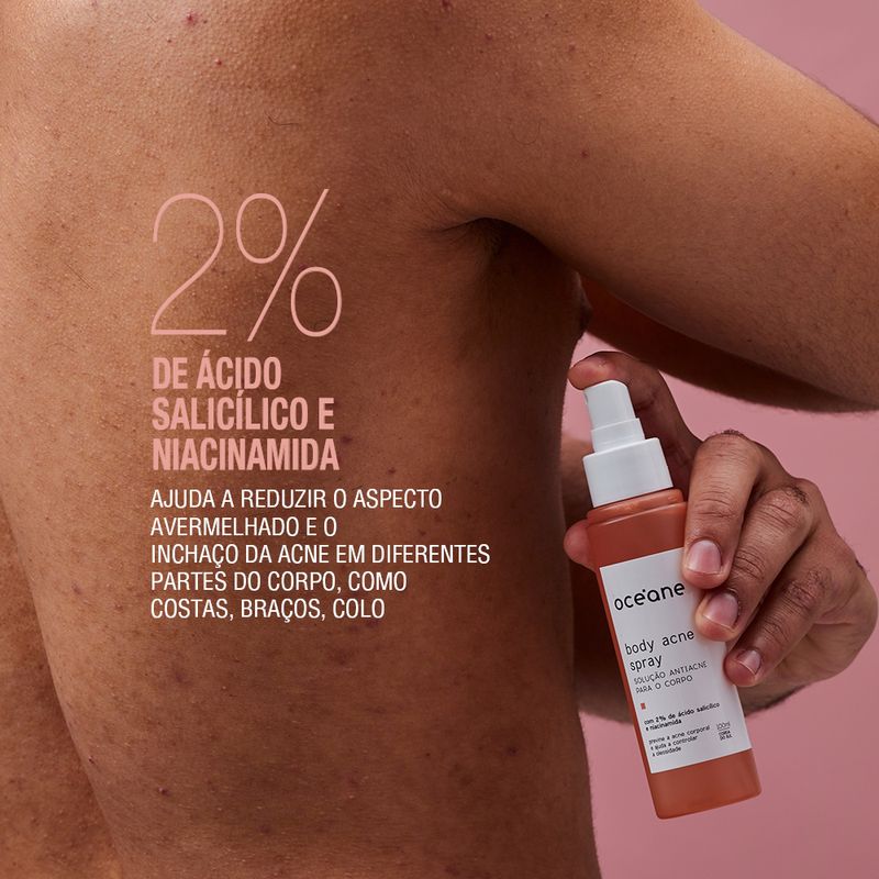 AP2001013CUNIT_solucao_antiacne_para_o_corpo_body_acne_spray_oceane_4-modelo-usando-e-porcentagem-com-os-ativos